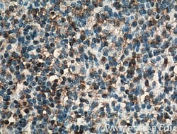 BSAP/PAX5 Rabbit anti-Human, Polyclonal, Proteintech:Anticuerpos:Anticuerpos
