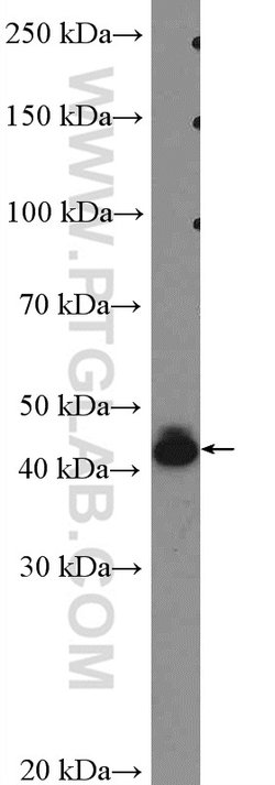 BSAP/PAX5 Rabbit anti-Human, Polyclonal, Proteintech:Anticuerpos:Anticuerpos