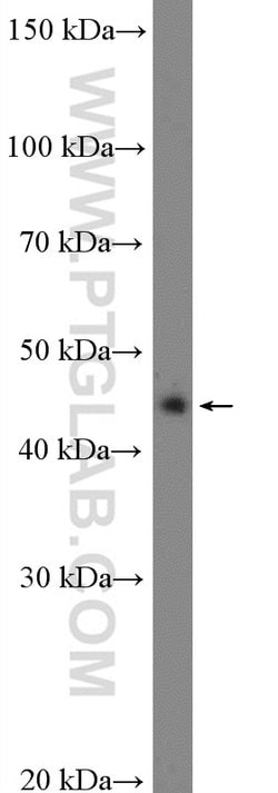 BSAP/PAX5 Rabbit anti-Human, Polyclonal, Proteintech:Anticuerpos:Anticuerpos