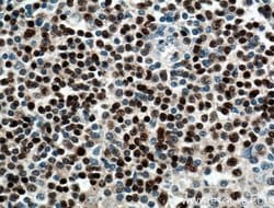 BSAP/PAX5 Rabbit anti-Human, Polyclonal, Proteintech:Anticuerpos:Anticuerpos