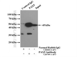 BSAP/PAX5 Rabbit anti-Human, Polyclonal, Proteintech:Anticuerpos:Anticuerpos