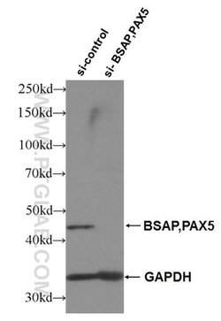 BSAP/PAX5 Rabbit anti-Human, Polyclonal, Proteintech:Anticuerpos:Anticuerpos