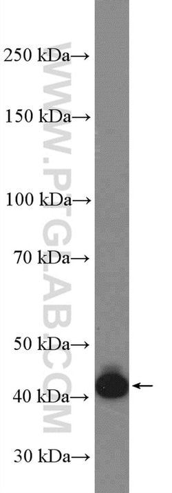 BSAP/PAX5 Rabbit anti-Human, Polyclonal, Proteintech:Anticuerpos:Anticuerpos