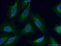 DNAJC3 Rabbit anti-Human, Mouse, Polyclonal, ProteinTech 150 &mu;L; Unconjugated:Antibodies,