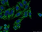 Thumbnail_TUFM Rabbit anti-Human, Mouse, Rat, Polyclonal, Proteintech 20 &mu;L; Unconjugated:Antibodies,