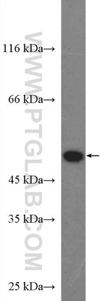 Thumbnail_TUFM Rabbit anti-Human, Mouse, Rat, Polyclonal, Proteintech 20 &mu;L; Unconjugated:Antibodies,