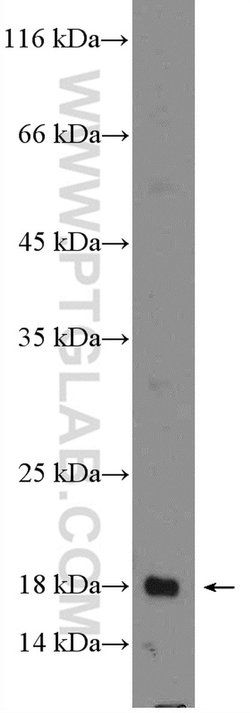 LIF Rabbit anti-Human, Polyclonal, Proteintech 20 &mu;L; Unconjugated:Antibodies,