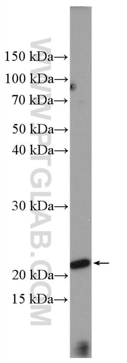 LIF Rabbit anti-Human, Polyclonal, Proteintech 20 &mu;L; Unconjugated:Antibodies,