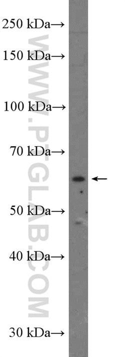 YTHDF1 Rabbit anti-Human, Polyclonal, Proteintech:Antibodies:Primary Antibodies