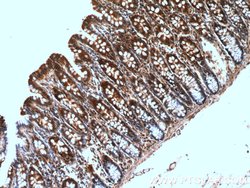 GRLF1 Rabbit anti-Human, Polyclonal, Proteintech:Antibodies:Primary Antibodies