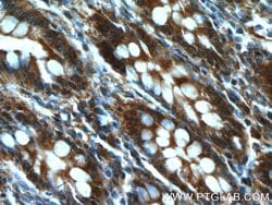 GRLF1 Rabbit anti-Human, Polyclonal, Proteintech:Antibodies:Primary Antibodies