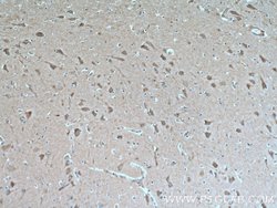 GRLF1 Rabbit anti-Human, Polyclonal, Proteintech:Antibodies:Primary Antibodies