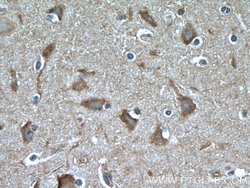 GRLF1 Rabbit anti-Human, Polyclonal, Proteintech:Antibodies:Primary Antibodies
