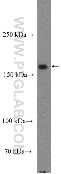GRLF1 Rabbit anti-Human, Polyclonal, Proteintech:Antibodies:Primary Antibodies