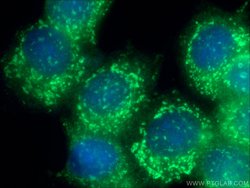 GPSM2 Rabbit anti-Human, Mouse, Rat, Polyclonal, Proteintech 150 &mu;L;