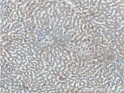 GPSM2 Rabbit anti-Human, Mouse, Rat, Polyclonal, Proteintech 150 &mu;L;