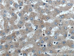 GPSM2 Rabbit anti-Human, Mouse, Rat, Polyclonal, Proteintech 150 &mu;L;