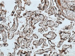 GPSM2 Rabbit anti-Human, Mouse, Rat, Polyclonal, Proteintech 150 &mu;L;