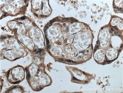 GPSM2 Rabbit anti-Human, Mouse, Rat, Polyclonal, Proteintech 150 &mu;L;