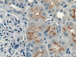 CLCN5 Rabbit anti-Canine, Human, Mouse, Polyclonal, Proteintech:Antibodies:Primary
