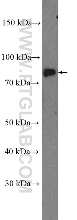 CLCN5 Rabbit anti-Canine, Human, Mouse, Polyclonal, Proteintech:Antibodies:Primary