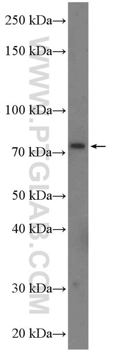 CLCN5 Rabbit anti-Canine, Human, Mouse, Polyclonal, Proteintech:Antibodies:Primary