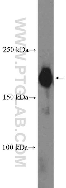 CRKRS Rabbit anti-Human, Polyclonal, Proteintech:Antibodies:Primary Antibodies
