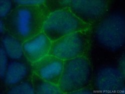 FLVCR1 Rabbit anti-Human, Mouse, Polyclonal, Proteintech:Antibodies:Primary