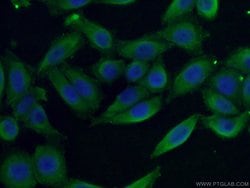 LTBP1 Rabbit anti-Human, Polyclonal, Proteintech 150 &mu;L; Unconjugated:Antibodies,