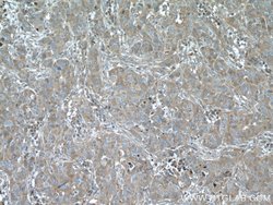 LTBP1 Rabbit anti-Human, Polyclonal, Proteintech 150 &mu;L; Unconjugated:Antibodies,