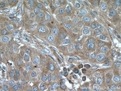 LTBP1 Rabbit anti-Human, Polyclonal, Proteintech 150 &mu;L; Unconjugated:Antibodies,