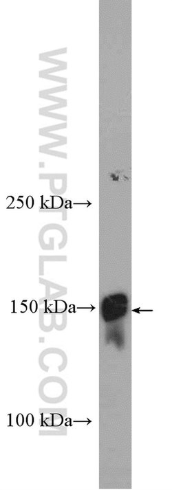 LTBP1 Rabbit anti-Human, Polyclonal, Proteintech 150 &mu;L; Unconjugated:Antibodies,