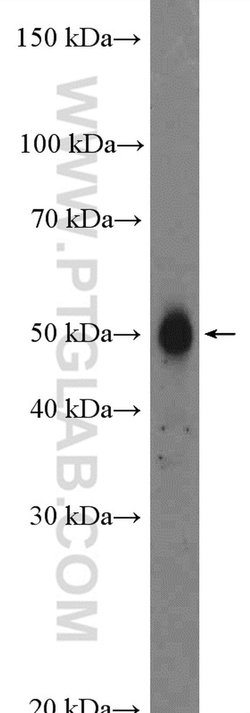 FAM175B Rabbit anti-Human, Mouse, Polyclonal, Proteintech 150 &mu;L; Unconjugated:Antibodies,