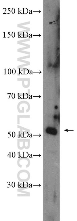 FAM175B Rabbit anti-Human, Mouse, Polyclonal, Proteintech 150 &mu;L; Unconjugated:Antibodies,