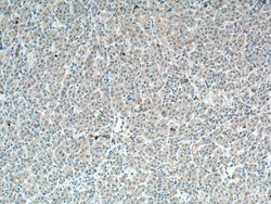 HGF alpha Rabbit anti-Human, Polyclonal, Proteintech:Antikörper:Primärantikörper