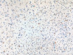TRIM47 Rabbit anti-Human, Polyclonal, Proteintech:Antibodies:Primary Antibodies