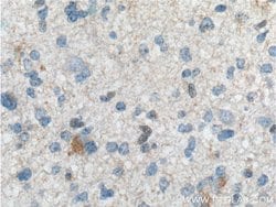 TRIM47 Rabbit anti-Human, Polyclonal, Proteintech:Antibodies:Primary Antibodies
