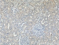 Proteintech TRIM47 Rabbit anti-Human, Polyclonal, Proteintech