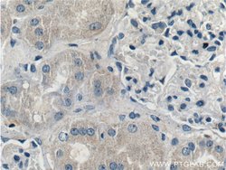 TRIM47 Rabbit anti-Human, Polyclonal, Proteintech:Antibodies:Primary Antibodies