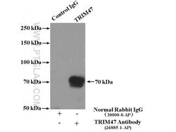 TRIM47 Rabbit anti-Human, Polyclonal, Proteintech:Antibodies:Primary Antibodies