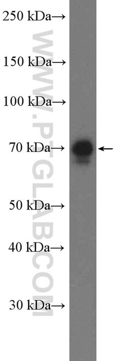 TRIM47 Rabbit anti-Human, Polyclonal, Proteintech:Antibodies:Primary Antibodies