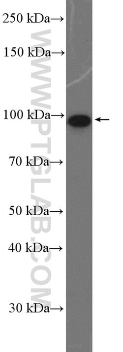 DDX54 Rabbit anti-Human, Polyclonal, Proteintech 150 &mu;L; Unconjugated:Antibodies,