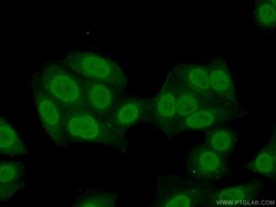 HNRNPM Rabbit anti-Human, Polyclonal, Proteintech:Antibodies:Primary Antibodies