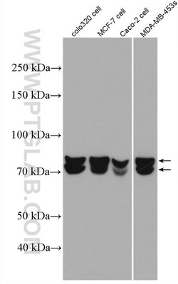 HNRNPM Rabbit anti-Human, Polyclonal, Proteintech:Antibodies:Primary Antibodies