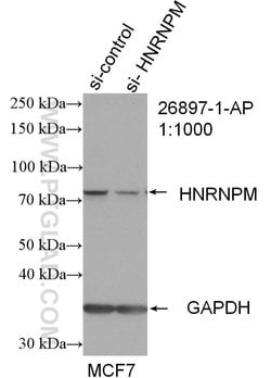 HNRNPM Rabbit anti-Human, Polyclonal, Proteintech:Antibodies:Primary Antibodies