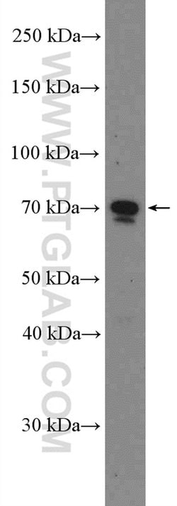 HNRNPM Rabbit anti-Human, Polyclonal, Proteintech:Antibodies:Primary Antibodies