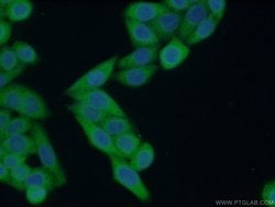 NDRG1 Rabbit anti-Human, Polyclonal, Proteintech 150 &mu;L; Unconjugated:Antibodies,