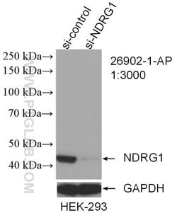 NDRG1 Rabbit anti-Human, Polyclonal, Proteintech 150 &mu;L; Unconjugated:Antibodies,
