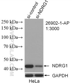 NDRG1 Rabbit anti-Human, Polyclonal, Proteintech 150 &mu;L; Unconjugated:Antibodies,