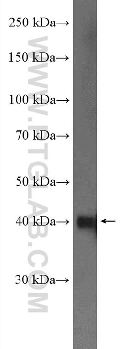 NDRG1 Rabbit anti-Human, Polyclonal, Proteintech 150 &mu;L; Unconjugated:Antibodies,